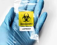 В Европе выявили проказу: средневековое заболевание обнаружили у границ с Украиной