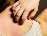 Массовая вспышка инфекции в школах Алчевска: оккупационные власти игнорируют угрозу